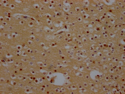 CRM1 Antibody (9F2)