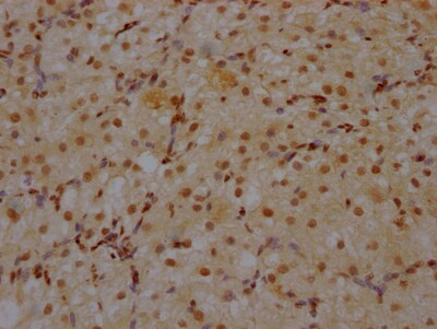 CRM1 Antibody (9F2)