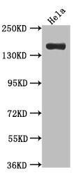 Xanthine Oxidase Antibody (8A9)