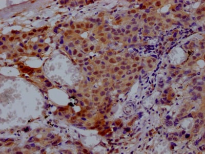 p97/VCP Antibody (5H12)