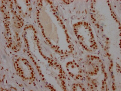 USP7 Antibody (7F10)