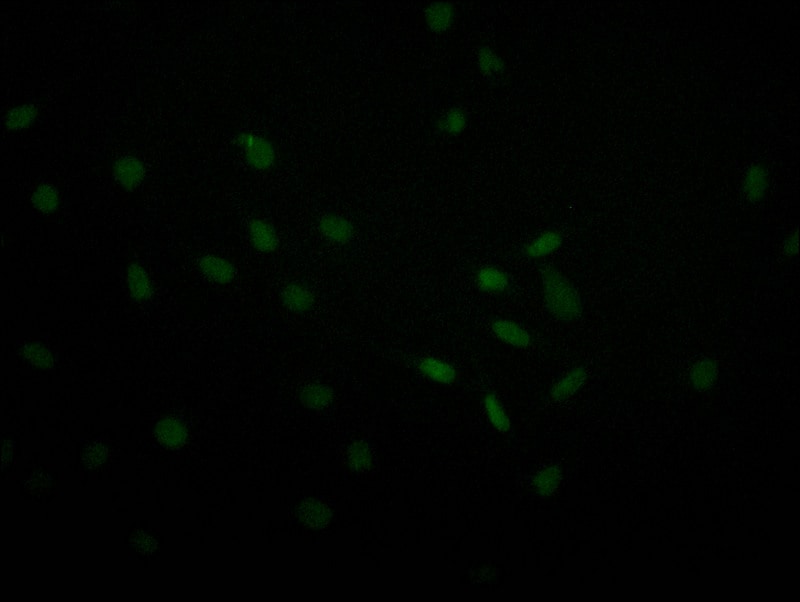 USP22 Antibody (18E3)