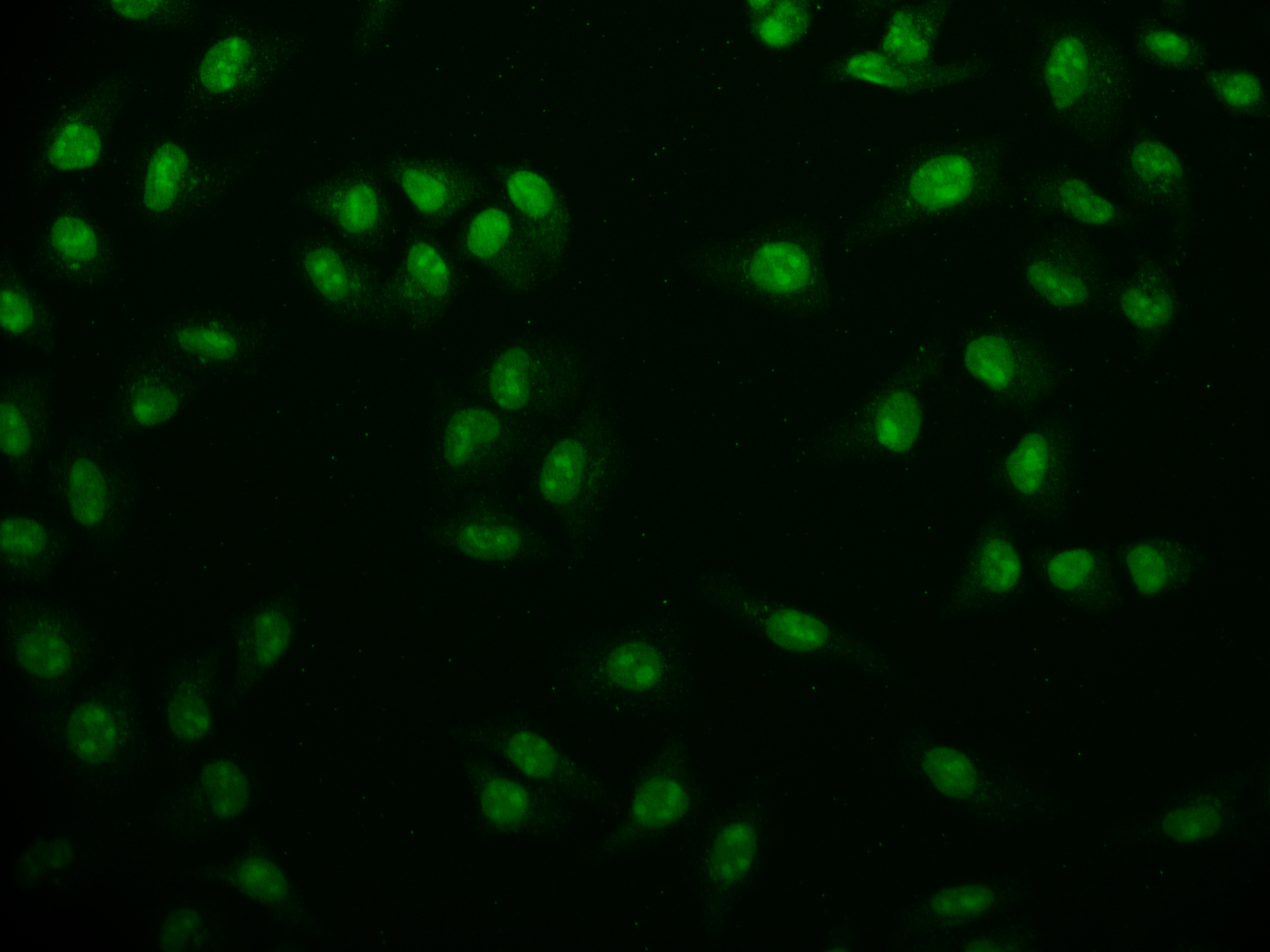 USP22 Antibody (18H6)