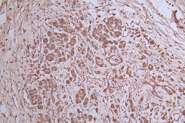 beta I Tubulin Antibody (16E2)