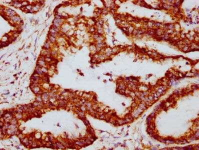 PBR Antibody (23G2)