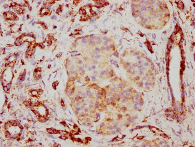 PBR Antibody (23G2)