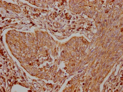 TRAF-2 Antibody (9A5)