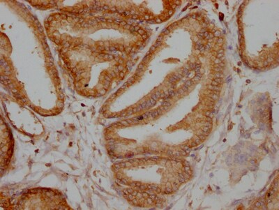 TPT1/TCTP Antibody (10A9)