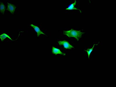 TPT1/TCTP Antibody (10A9)