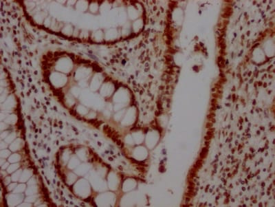 Topoisomerase I Antibody (6D8)