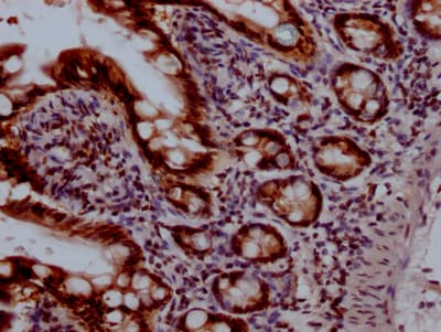 Topoisomerase I Antibody (6D8)