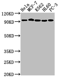 Topoisomerase I Antibody (6D8)