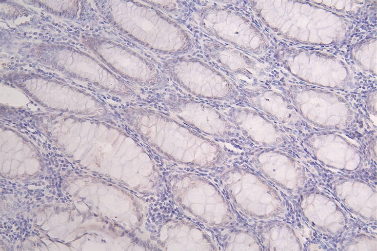 Troponin T Type 2 (cardiac) Antibody (8H8)
