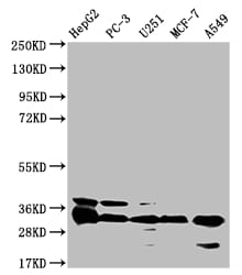 TMEM192 Antibody (21G8)