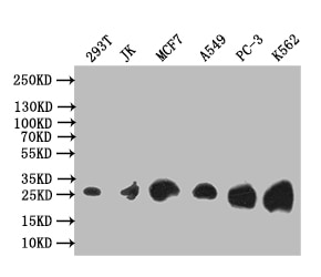 Thymidine Kinase 1 Antibody (6F6)