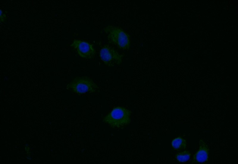 Thymidine Kinase 1 Antibody (6F6)