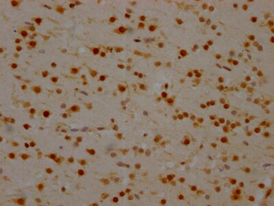 hnRNP-Q Antibody (9C7)
