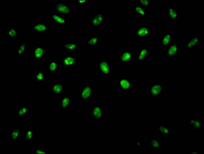 hnRNP-Q Antibody (9C7)