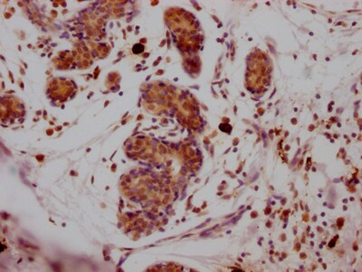 SUZ12 Antibody (1B10)