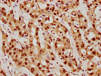 SUMO1 Antibody (5G3)