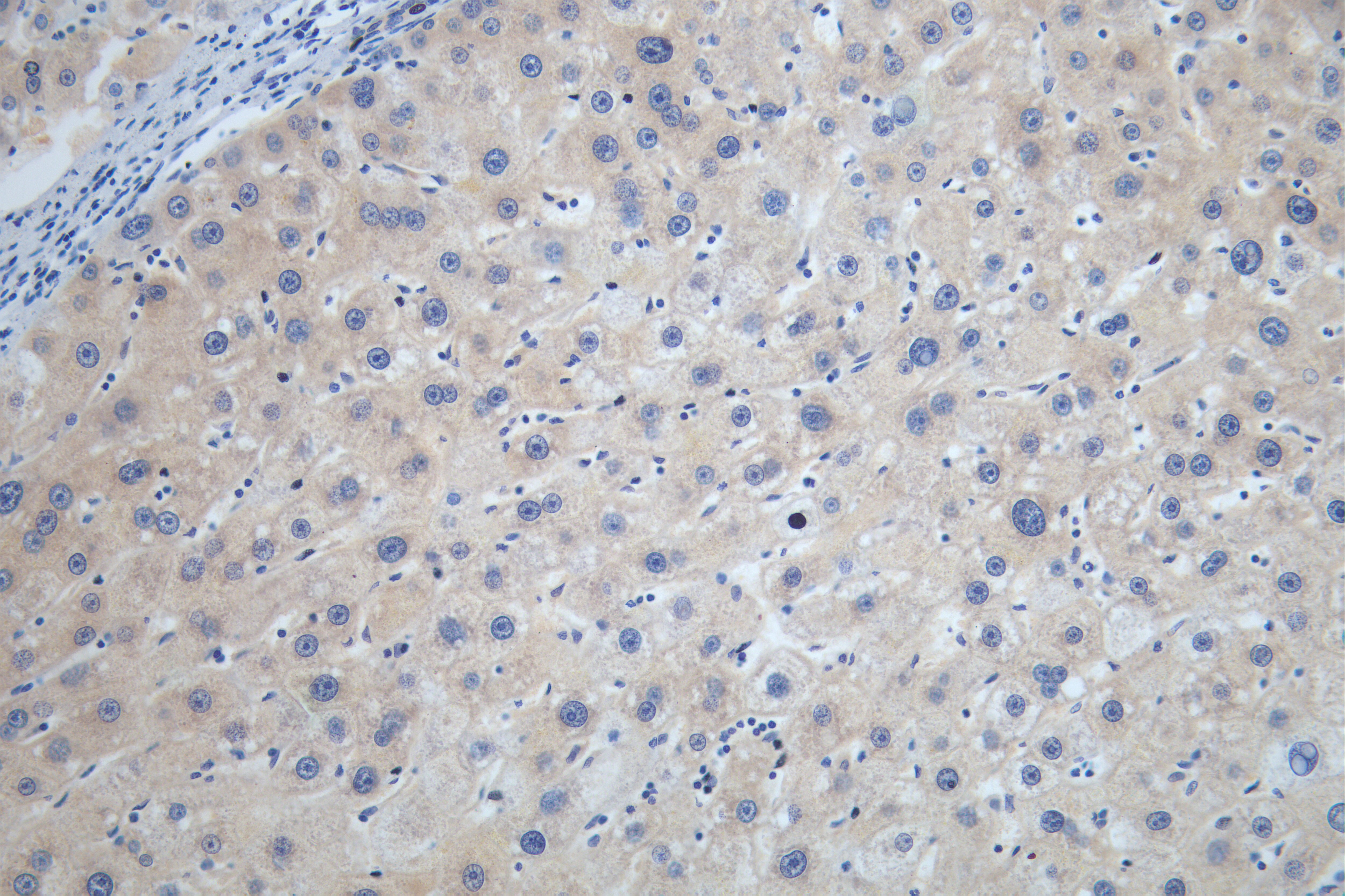 STK33 Antibody (5H11)