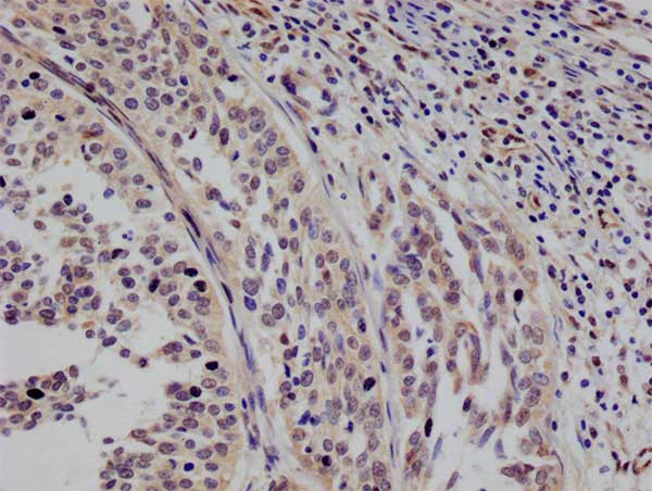 STAT4 Antibody (26G2)