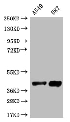 Serine racemase Antibody (12B2)