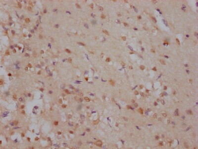 SOX2 Antibody (2E1)