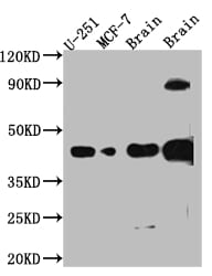SOX2 Antibody (2E1)