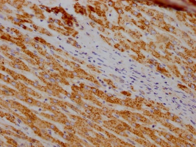 SOD2/Mn-SOD Antibody (10F6)