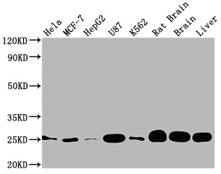 SOD2/Mn-SOD Antibody (10F6)