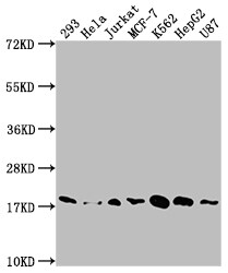 SOD1/Cu-Zn SOD Antibody (3E5)