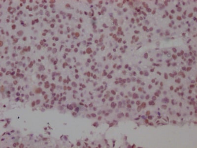 SMC1 Antibody (8C11)