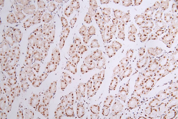 Brg1 Antibody (22F3)