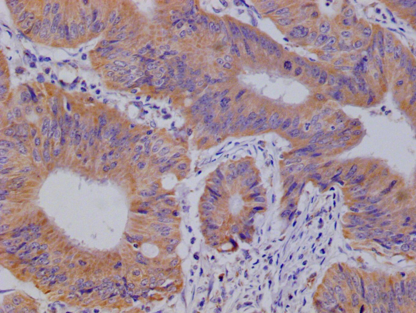 Glut3 Antibody (14B1)
