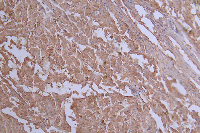 Glut2 Antibody (37E1)