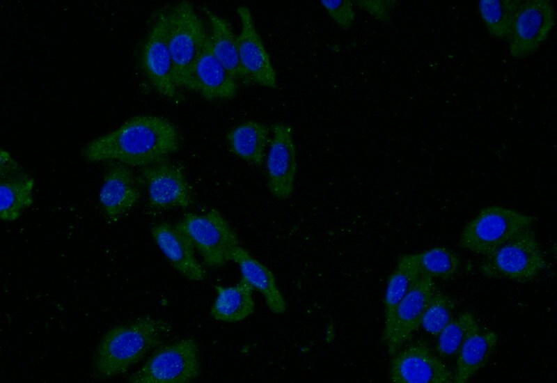 Glut2 Antibody (37E1)