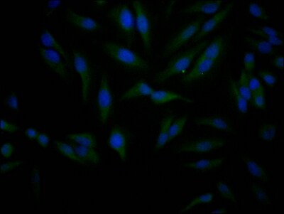 Sirtuin 1/SIRT1 Antibody (9E9)