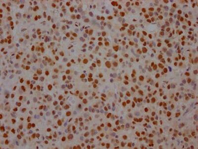 SAP155 Antibody (6C7)