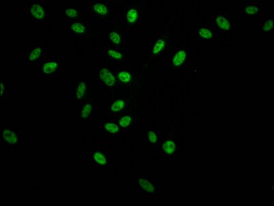 SAP155 Antibody (6C7)