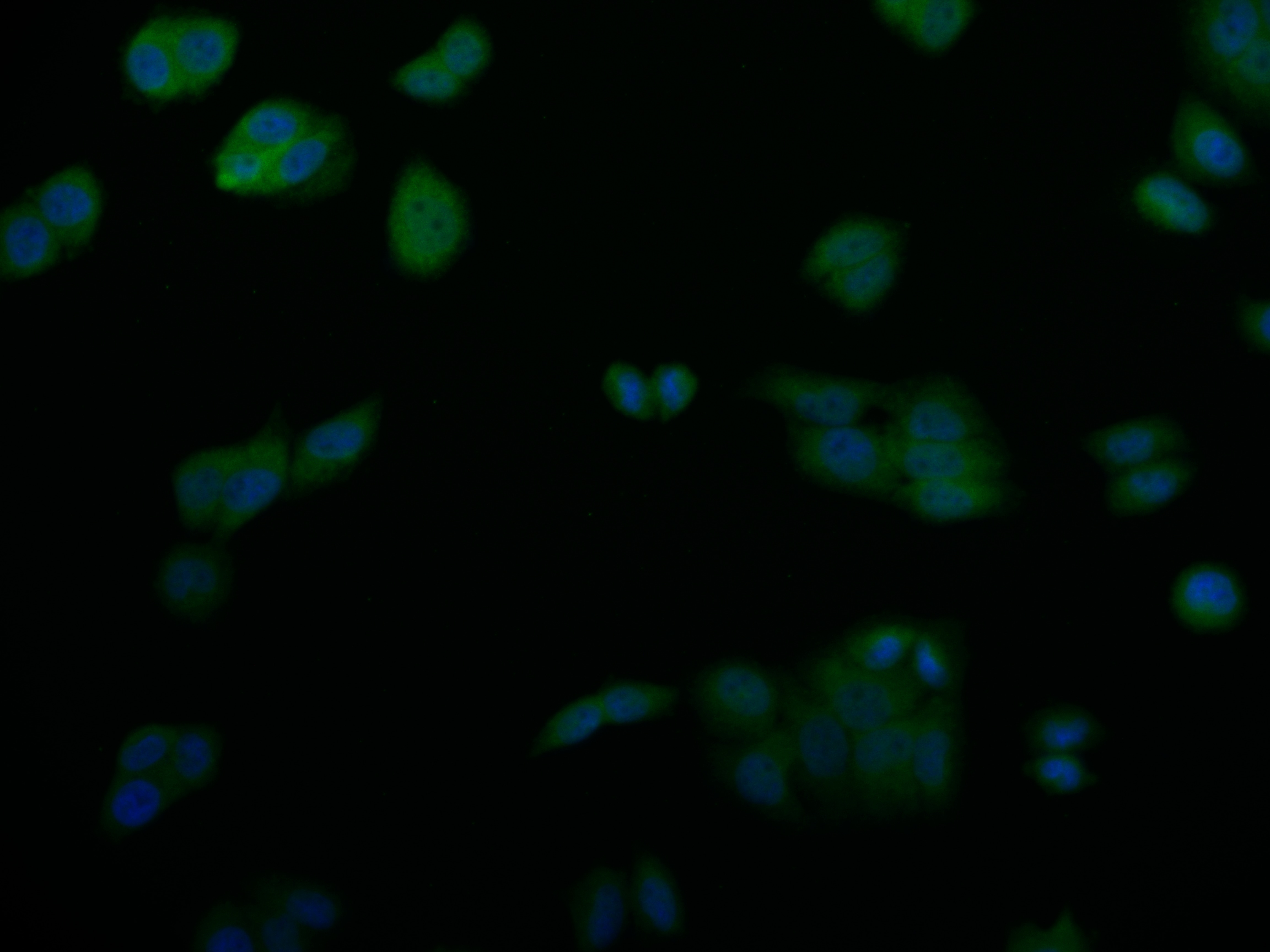 SENP1 Antibody (25H2)