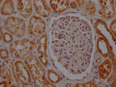 SDHB Antibody (7D12)