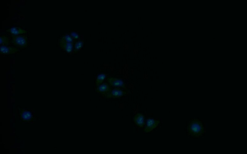 Syntenin 1 Antibody (19C1)