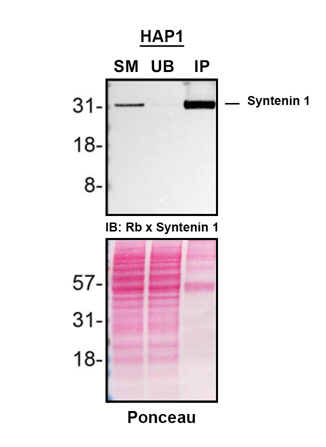 Syntenin 1 Antibody (19C1) - BSA Free Detection of Syntenin 1 by Immunoprecipitation.
