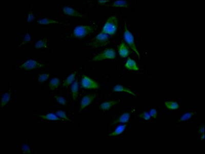 SUMO Activating Enzyme E1 (SAE1) Antibody (9D8)