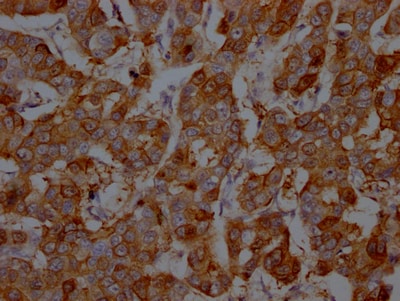 S100A9 Antibody (2E9)