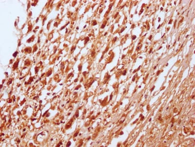 RNF20 Antibody (2H12)