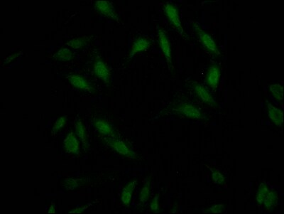 RNF20 Antibody (2H12)
