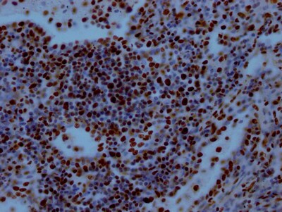 RBBP4/RbAp48 Antibody (3E9)