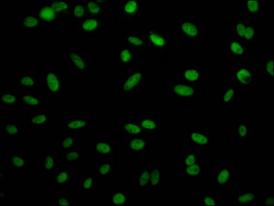 RBBP4/RbAp48 Antibody (3E9)